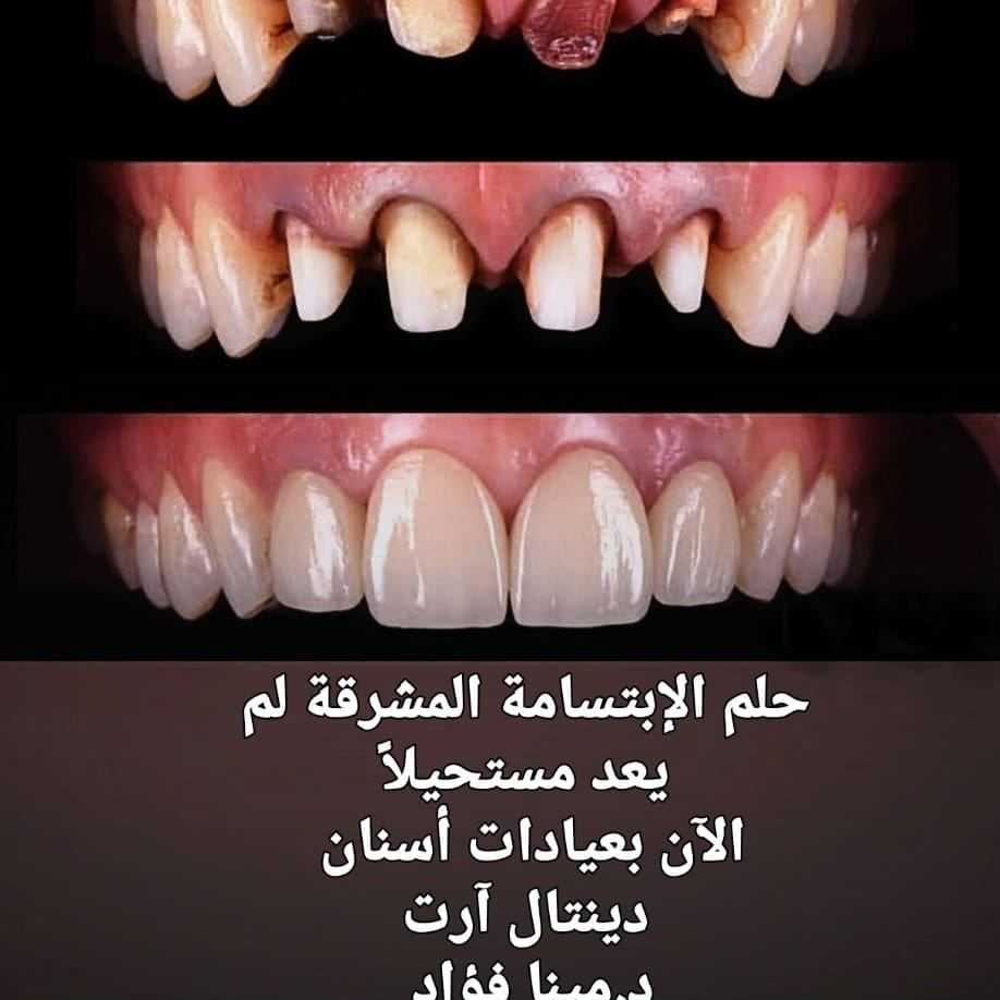 Dental Art Clinic Dr.Mina Fouad
