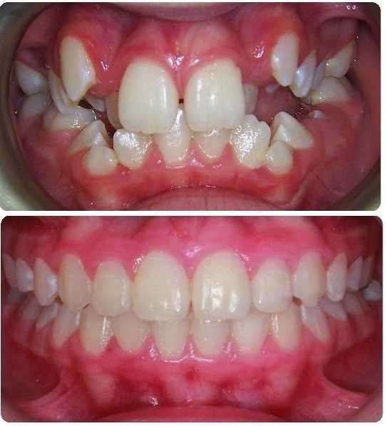 Orthodonticsiniran5.jpg