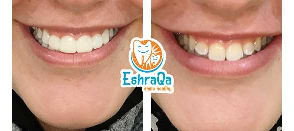acd6b658-88d8-4ef4-ad18-1f3ed516f894.jpg